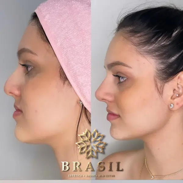 Profissional Salão de Beleza Center